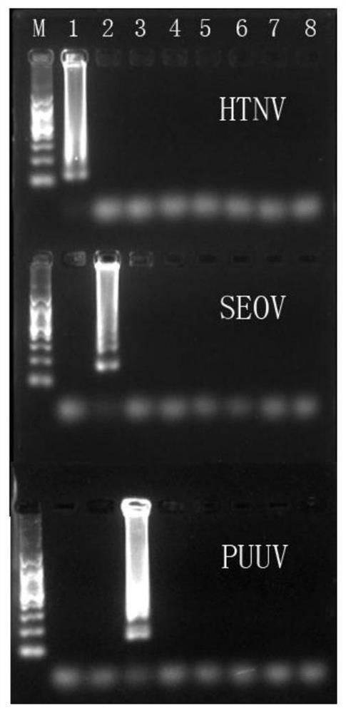 用于檢測漢坦病毒的檢測引物、檢測試劑盒及檢測方法