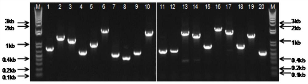 一種棘阿米巴特異性抗原肽、多克隆抗體及其用途